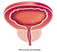 Prostate Care